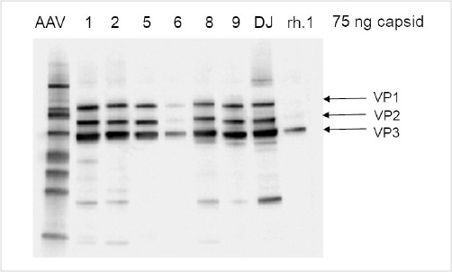 VP1 VP2 VP3 protein Analysis of AAV Capsids by Western blot