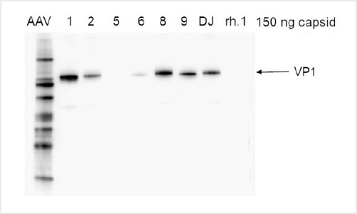 VP1 protein Analysis of AAV Capsids by Western blot
