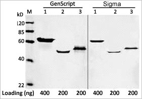 DYKDDDDK Tag Antibody