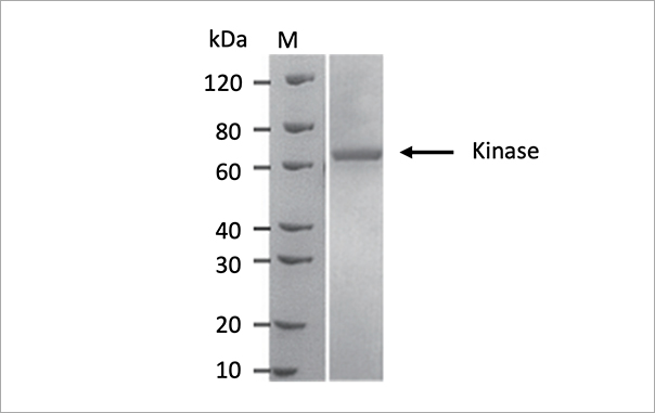 Sf9细胞成功表达Kinase，纯度95%，表达量10mg/L