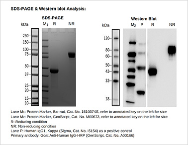 SDS-PAGE & Western blot analysis